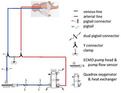 The Role of Echocardiography in Neonates and Pediatric Patients on Extracorporeal Membrane Oxygenation